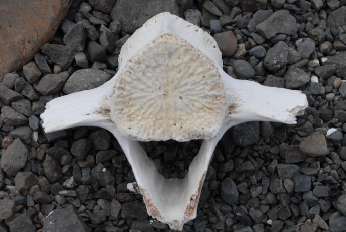 Vertebra